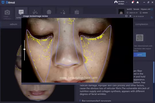 Analysis and reporting Interface