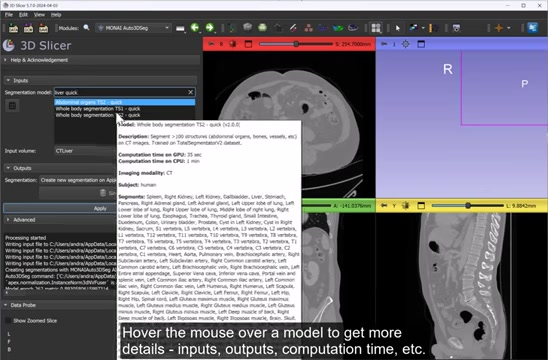 3D Slicer & MONAI: Fast Medical Image Segmentation Guide