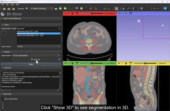 3D Slicer & MONAI: Fast Medical Image Segmentation Guide