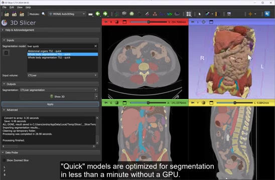 3D Slicer & MONAI: Fast Medical Image Segmentation Guide