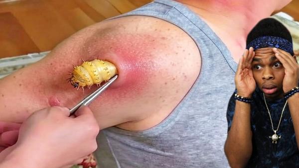 Miniatura di reazione a un video disgustoso