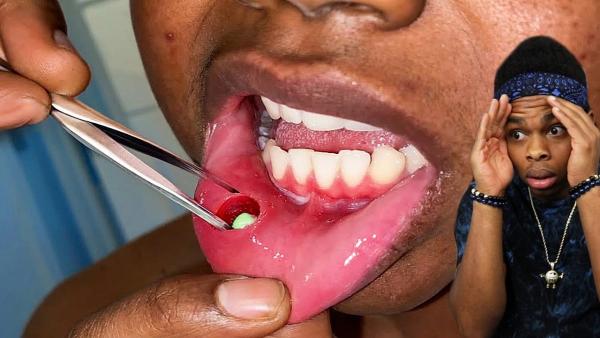 Miniatura di reazione medica scioccante